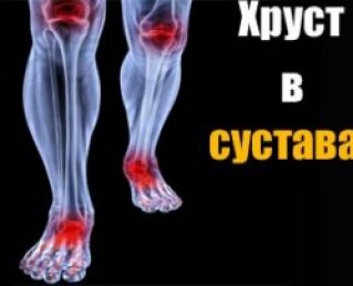 Почему хрустят колени или крепитация коленного сустава