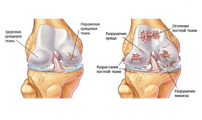 Бросил курить но бросить пить