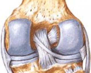 Что нужно знать о растяжении связок колена?