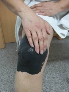 Лечение коленного сустава грязами 