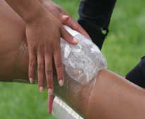 Лед, приложенный к колену при спортивной травме