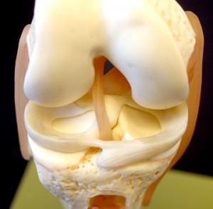 Изображение - Артроскопия коленного сустава при повреждении мениска artroskopija-meniska-300x295