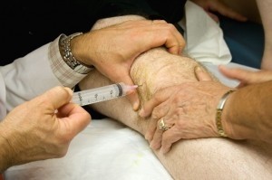 Инъекции при лечении остеартроза коленного сустава